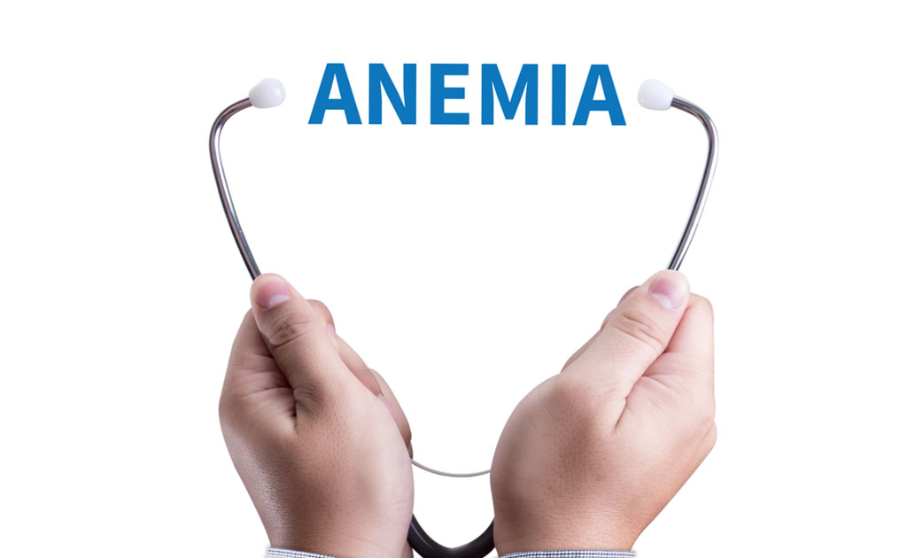 আয়রন ডিফেসেন্সি হলে কোন লক্ষণগুলো দেখে বুঝবেন?