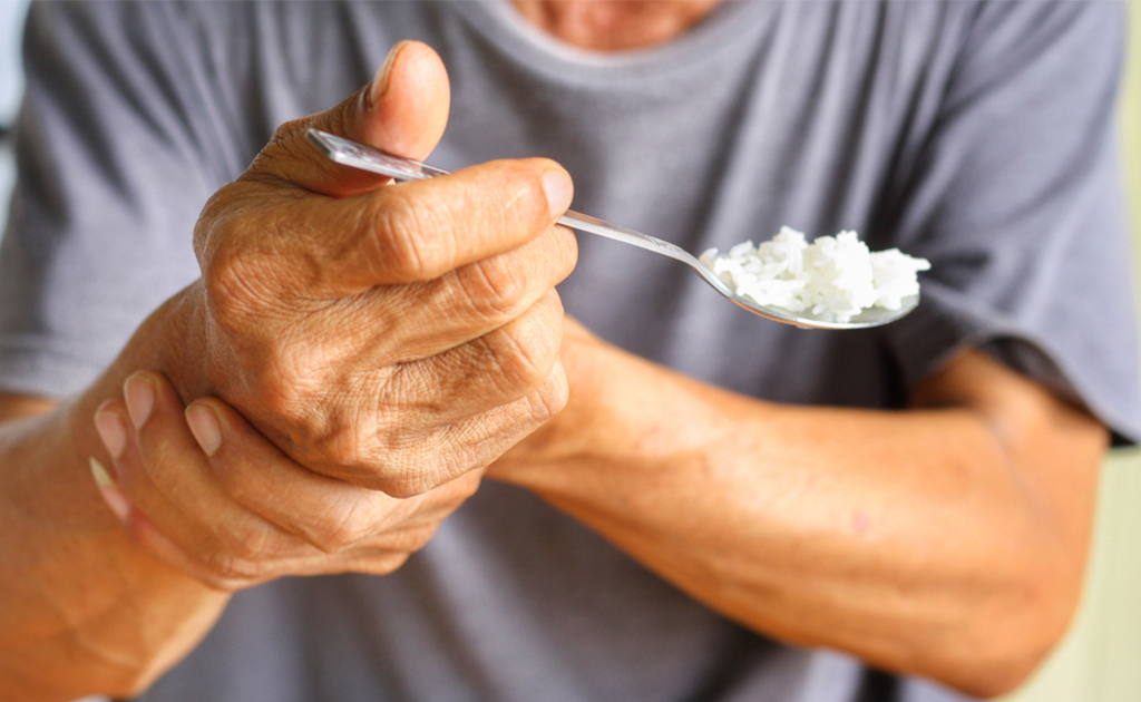 পারকিনসন ডিজিজ বা অনিয়ন্ত্রিত হাতের কাঁপুনি হওয়ার কারণ ও চিকিৎসা