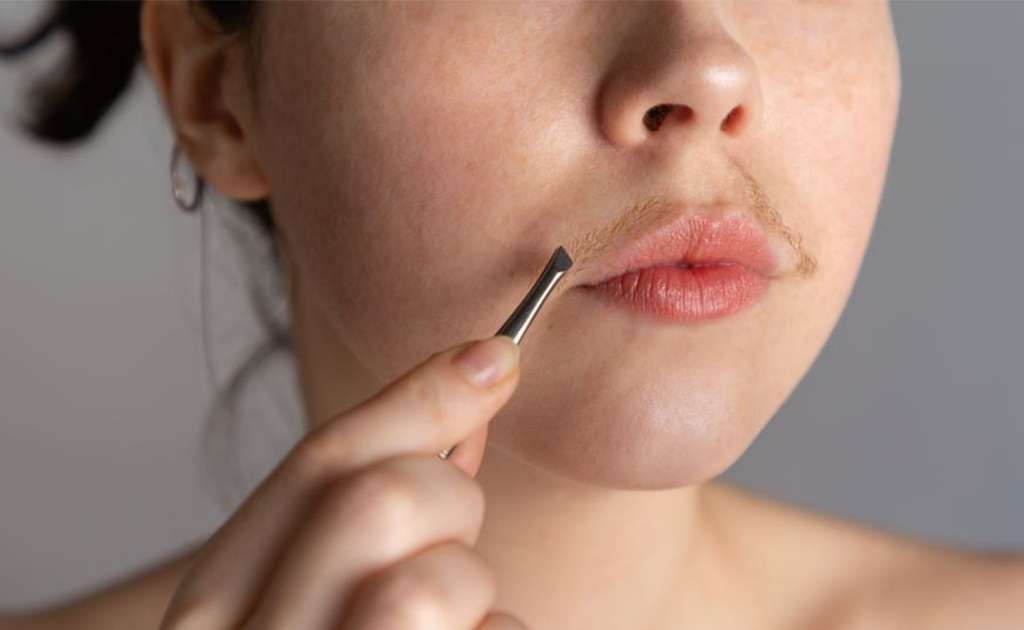 মেয়েদের অবাঞ্ছিত লোম বা অতিরিক্ত ফেসিয়াল হেয়ার কেন হয় জানেন কি?