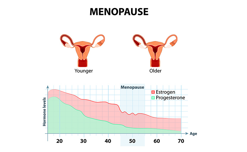 মাসিক বন্ধ হয়ে যাওয়া | কারণ, লক্ষণ ও চিকিৎসা জানেন কি?