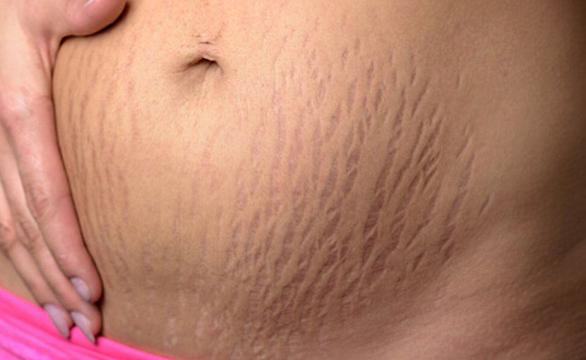 মায়ের যত্ন | বাচ্চা হওয়ার পর সেলফকেয়ার কিভাবে করবেন?